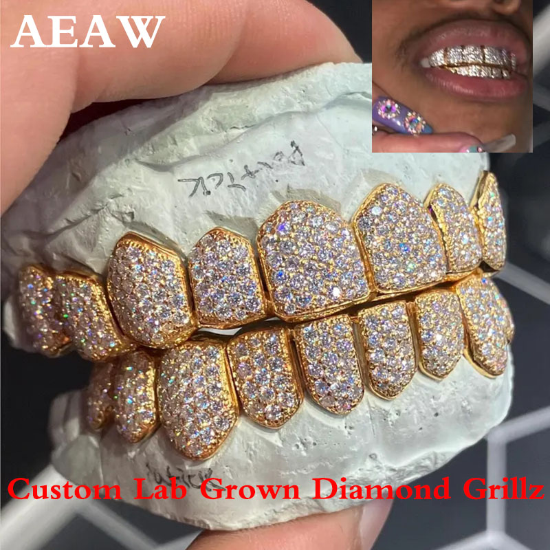 Yellow Body Jewelry - Grillz Hip Hop Personalizzati con Diamanti